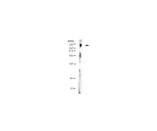 62-8498-10　反亨廷顿，也是。1-82;100μL　MAB5492