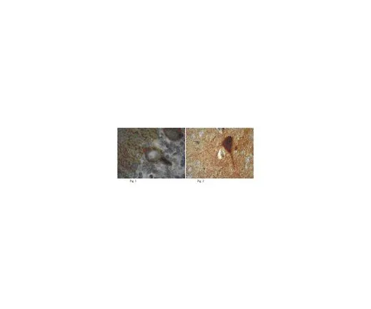 62-8516-60　反泛MAGUK,克隆K28/86;100μg　MABN72