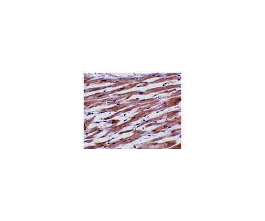 62-8470-12　反UNG1　ABS449