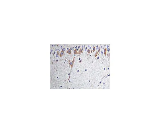 62-8497-79　抗硝基酪氨酸，克隆2A8.2;100μg　MAB5404