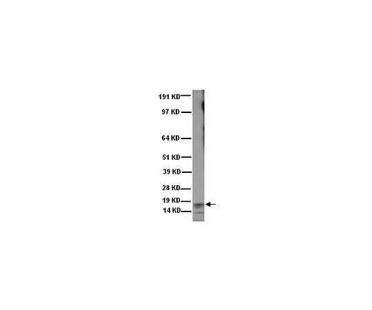 62-8491-42　抗Frataxin,外显子4,克隆1G2;100μL　MAB1594