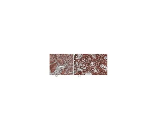 62-8525-51　抗Arp2/3复合物，克隆13C9;100μL　MABT95
