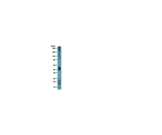 62-8493-45　反Tau,克隆Tau 7;100μg　MAB2239