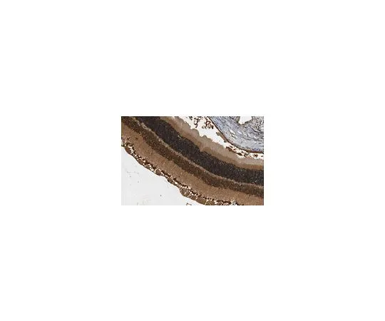 62-8473-99　反激进主义　ABT1373