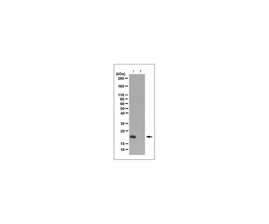 62-8524-71　抗N1-磷酸组氨酸抗体，克隆SC50-3　MABS1341