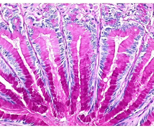 61-0286-87　具有滑动玻璃和参考组织的ISOSLIDE (R) PAS用于检测组织中的多糖100408 1 ST　1.00408.0001