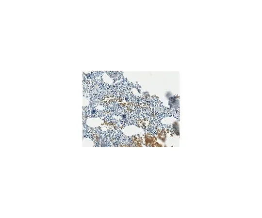 62-8492-13　抗前胶原I型抗体，CT,克隆PCIDG10 (无腹水)　MAB1913-C