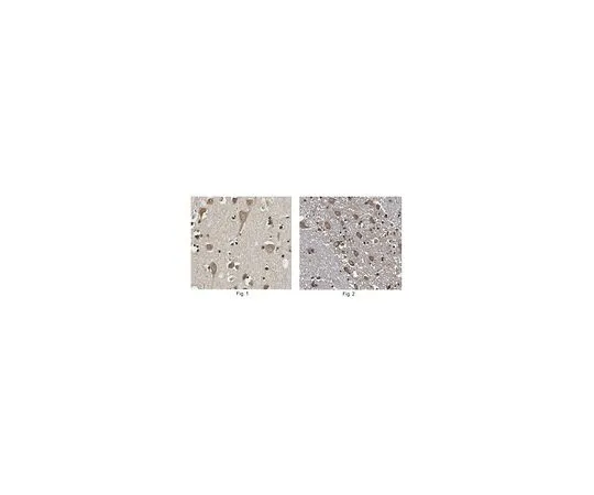62-8471-19　反FBP38　ABS992