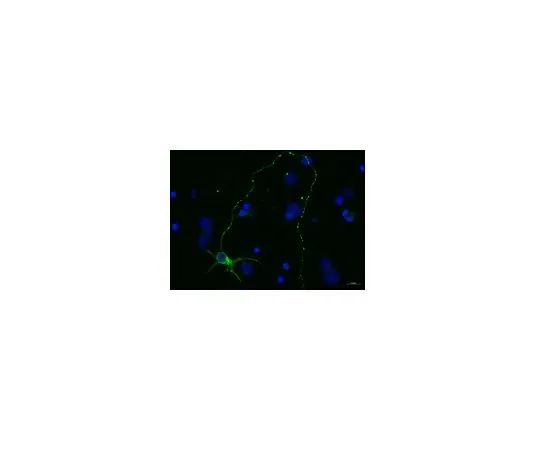 62-8479-68　抗球蛋白β-III,克隆TU-20, Alexa Fluor (R) 488共轭;40μL　CBL412X