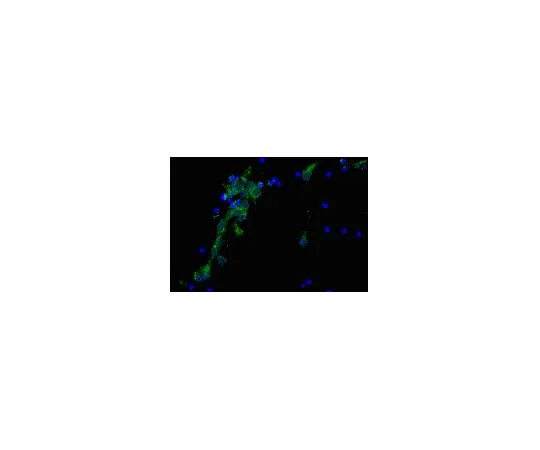 62-8488-92　抗阿尔茨海默病前体蛋白A4,克隆22C11,生物素Conj。;100μL　MAB348B