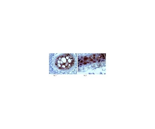 62-8525-46　抗凝集素，克隆1-C-6;100μg　MABT84
