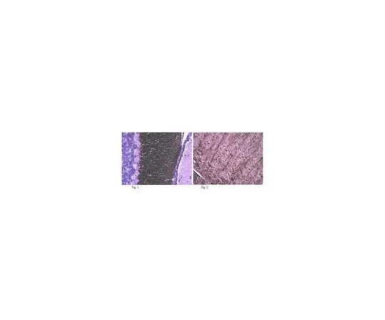 62-8516-57　抗Caspr,克隆K65/35;100μg　MABN69