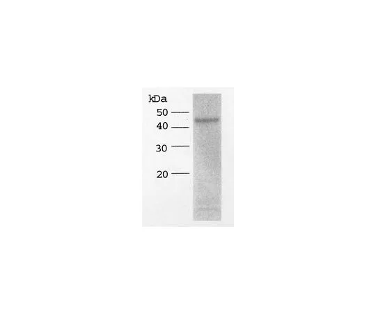 62-8480-56　ADAMTS-4,重组，他的标记;5μg　CC1028