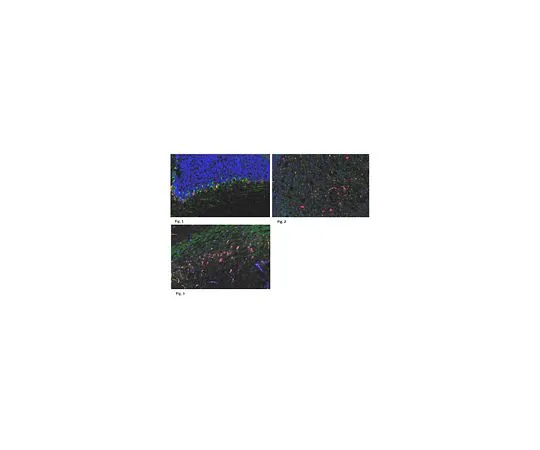 62-8472-72　抗CELSR1;100μg　ABT119