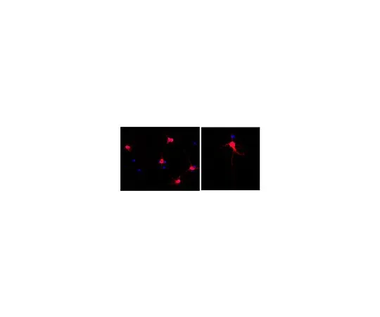 62-8494-84　抗MAP2,克隆AP20,Alexa Fluor (R) 555共轭;100μL　MAB3418A5