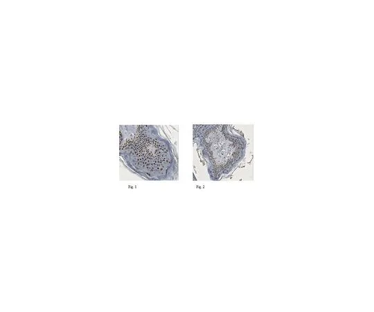 62-8502-05　抗XBP1抗体，克隆143F (活性形式) 猫。不是，是MABC521　MABC521