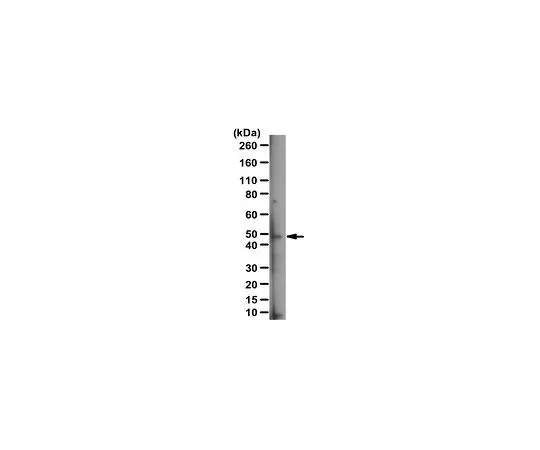 62-8471-82　反伦纳克抗体　ABS1624