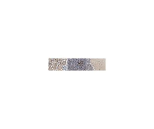 62-8503-72　抗LMO-2 (Rhombotin-2) 抗体，克隆1A9-3B11　MABC1144