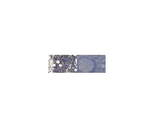 62-8526-91　抗MMP-9抗体，克隆3D6.3　MABT531