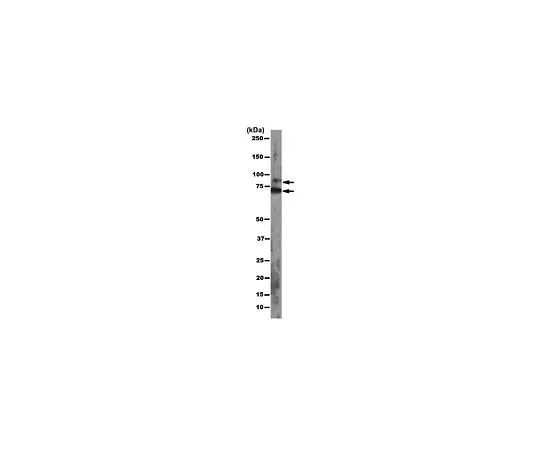 62-8504-89　反盘阿甘，克隆2A8;100μg　MABE56