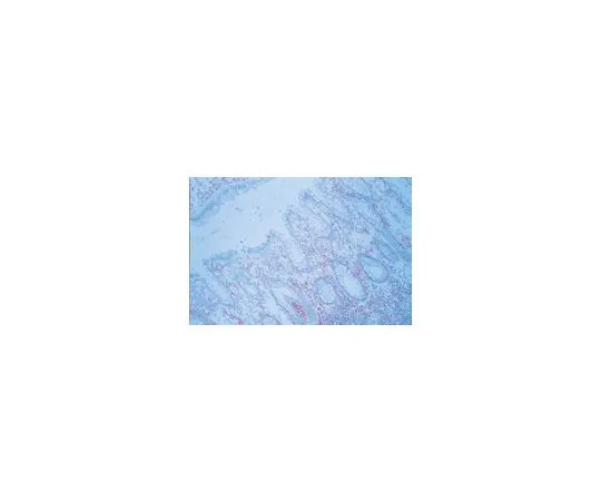 62-8493-28　抗ICAM-1,克隆P2A4;100μg　MAB2146