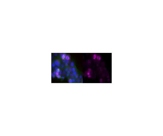 62-8500-63　抗层粘连蛋白5抗体 (γ2链) ，克隆D4B5, Alexa Fluor (R) 647共轭　MAB19562-AF647