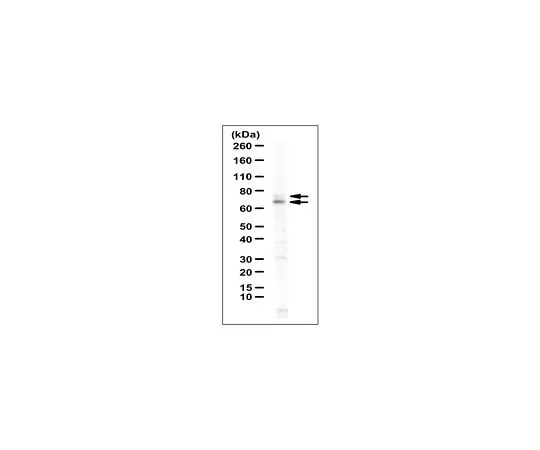 62-8471-28　抗MTHFR抗体　ABS1013