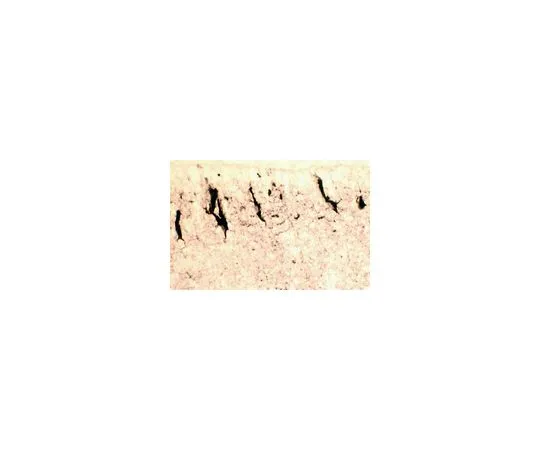62-8497-70　反雷林，也是。164-189mreelin,克隆142;100μg　MAB5366