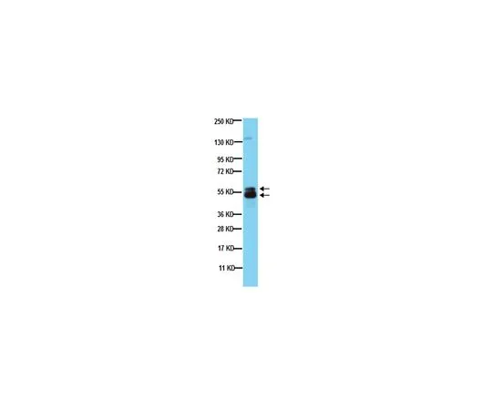 62-8495-55　抗眼炎，克隆C5;100μg　MAB3747-I