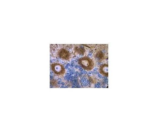 62-8516-39　反潘申克，克隆N23B/49;100μg　MABN24