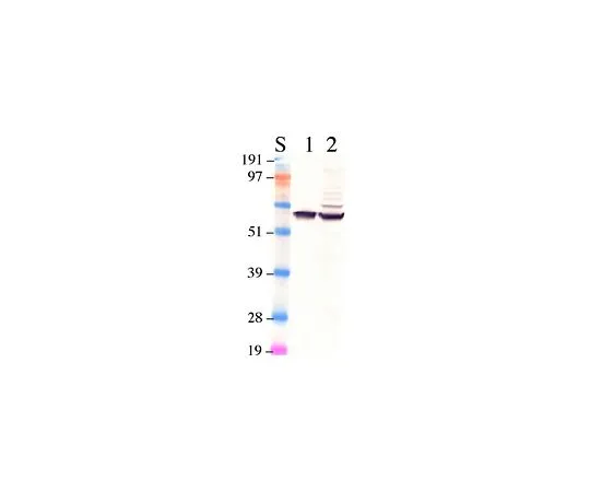 62-8497-88　抗视网膜色素上皮65;100μg　MAB5428