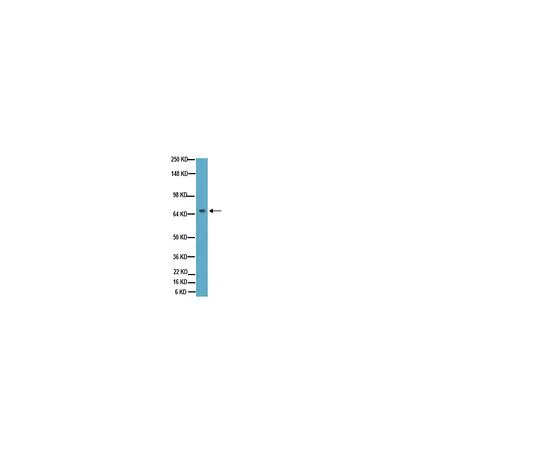 62-8489-06　反陶，a.a。210-241,克隆Tau-5;100μL　MAB361