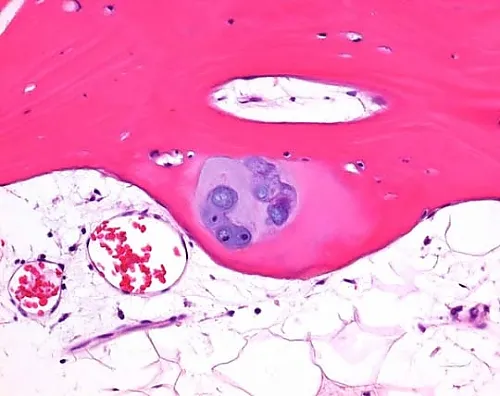 61-0290-53　OSTEOMOLL (R) 组织学快速脱钙剂溶液101736 1 L　1.01736.1000