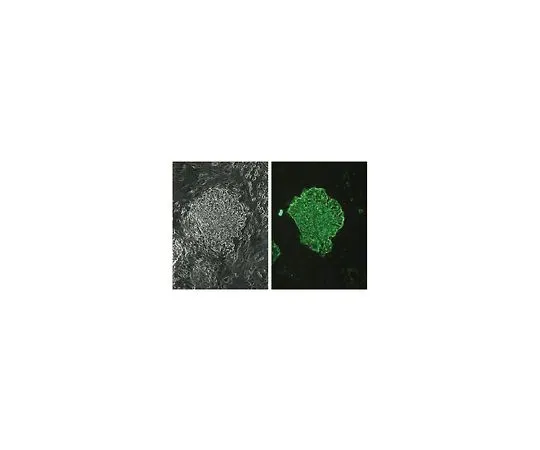 62-8496-32　抗阶段特异性胚胎抗原-4,克隆MC-813-70;100μg　MAB4304