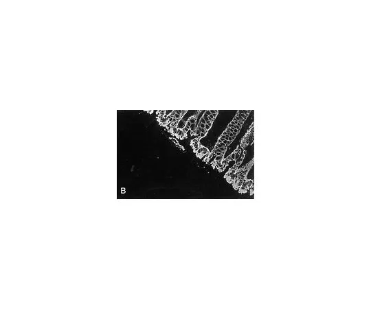 62-8494-51　抗细胞角蛋白5,8;100μg　MAB3228