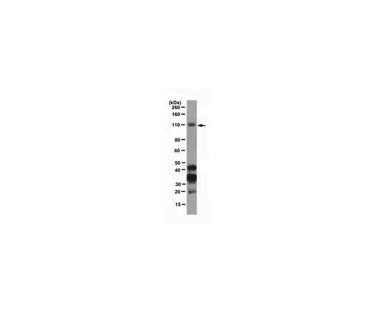 62-8505-76　抗Dnmt3b,克隆D3B2-2C1;100μg　MABE305