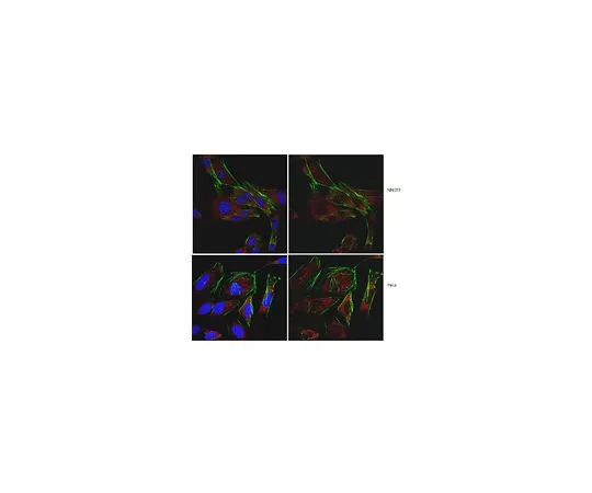 62-8472-65　抗SDHD (CybS)　ABT110