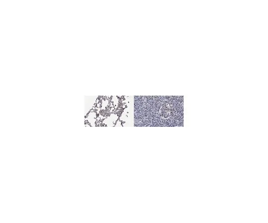 62-8470-80　抗表面活性蛋白D　ABS574