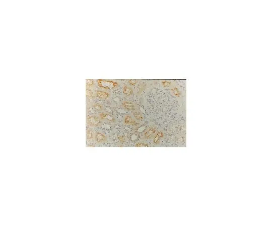 62-8496-04　抗MDR1,克隆JSB-1;100μg　MAB4120