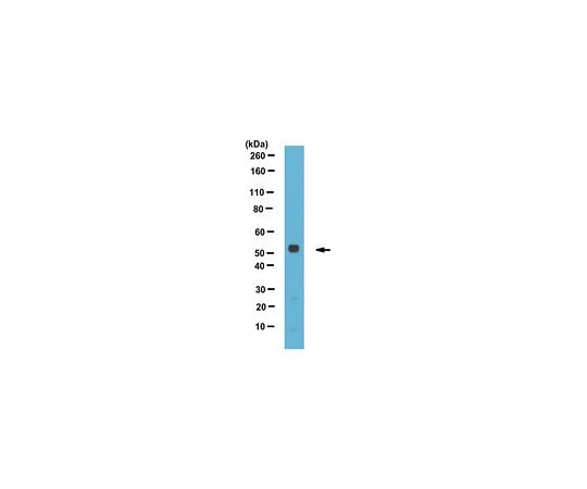 62-8470-32　抗perilipin-3,C-Terminal　ABS482