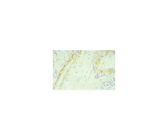 62-8479-80　抗PECAM-1,人PECAM-1结构域3-6,克隆HC1/6;100μg　CBL468