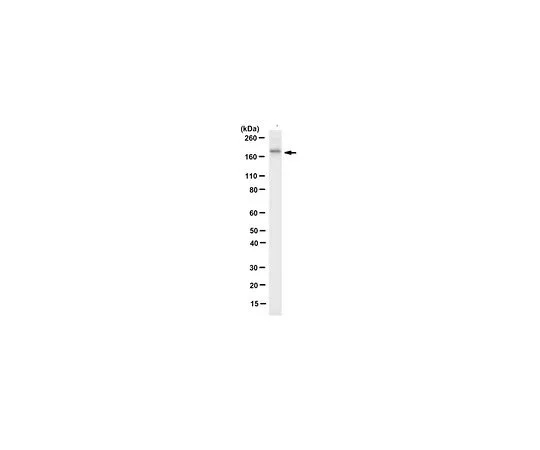 62-8502-32　反FANCA,克隆5G9　MABC557