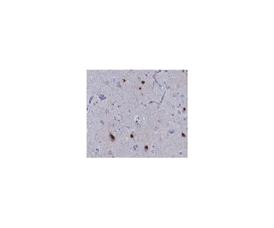 62-8516-74　反ARX　MABN102