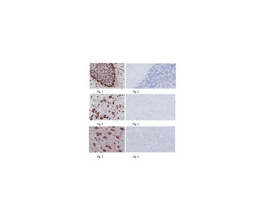 62-8505-61　反武藏-1,克隆7B11.1;100μg　MABE268