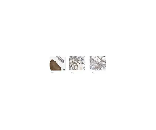 62-8526-03　抗COL1A2,克隆α2CT,无氮化物　MABT200
