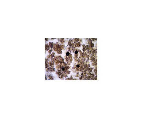62-8509-03　抗TRACP,克隆9C5;100μg　MABF96