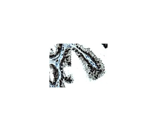 62-8521-89　抗GREB1,克隆GREB1Ab;100μg　MABS62