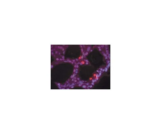 62-8531-20　ApopTag (R) 阳性对照幻灯片，断奶后4天大鼠 腺;5个月　S7115