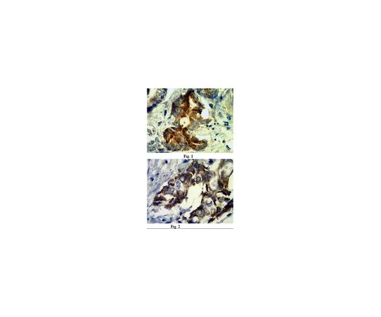 62-8525-36　抗核素-4/PVRL4,克隆N4.61;100μg　MABT64