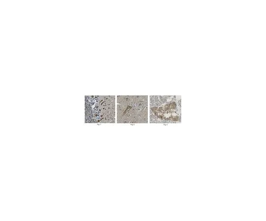 62-8519-96　抗Cav1.2α1c,克隆8F9.1　MABN863